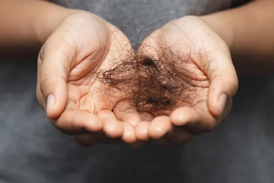 بالوں کا گرنا کیا ہے؟ وجوہات اور علاج جانیں